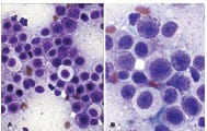 Treating Mast Cell Tumors in Dogs: A Microscope Image of Mast Cells
